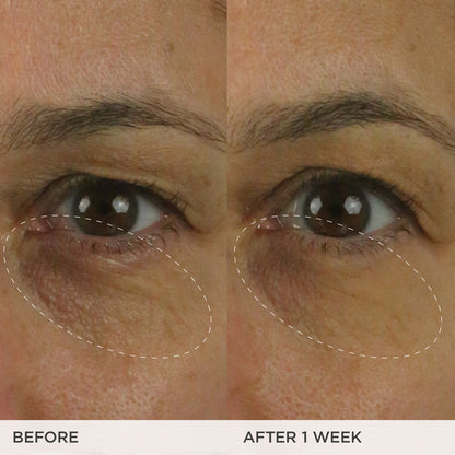 The Brightening Eye Cream